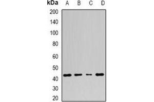 Western blot analysis of Adenosine Deaminase expression in A549 (A), Jurkat (B), mouse spleen (C), mouse stomach (D) whole cell lysates. (ADA antibody)
