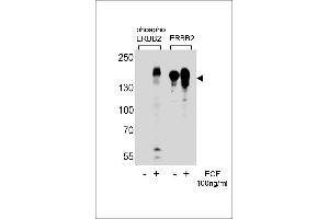 Western blot analysis of extracts from A431 cells,untreated or treated with EGF,100 ng/mL,using phospho ErbB2-(left) or ErbB2 Antibody (right) (ErbB2/Her2 antibody  (pTyr1221))