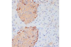 Immunohistochemistry of paraffin-embedded mouse pancreas using PTPRN2 antibody (ABIN7269710) at dilution of 1:100 (40x lens).