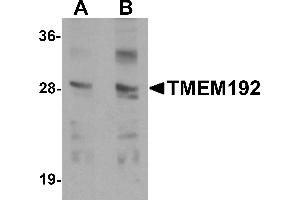 Western blot analysis of TMEM192 in SK-N-SH cell lysate with TMEM192 antibody at (A) 0. (TMEM192 antibody  (C-Term))