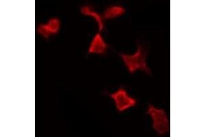 Immunofluorescence (fixed cells) (IF/ICC) image for anti-Nuclear Factor of kappa Light Polypeptide Gene Enhancer in B-Cells Inhibitor, alpha (NFKBIA) (C-Term) antibody (ABIN6262505)