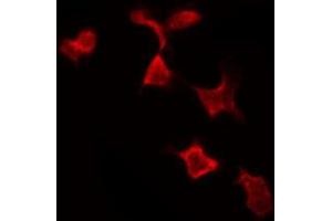 ABIN6269199 staining MCF7 by IF/ICC. (NFKBIA antibody  (C-Term))