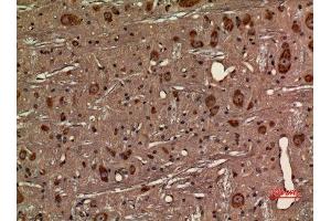 Immunohistochemistry (IHC) analysis of paraffin-embedded Rat Brain, antibody was diluted at 1:100. (CX3CR1 antibody  (Internal Region))