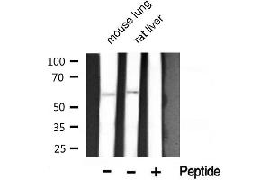 Western blot analysis of Akt1 phosphorylation expression in mouse lung and rat liver lysates,The lane on the right is treated with the antigen-specific peptide. (AKT1 antibody  (pThr450))