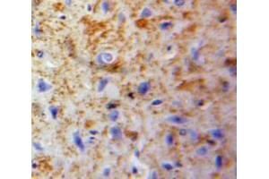 IHC-P analysis of Brain tissue, with DAB staining. (Neuroglobin antibody  (AA 1-151))
