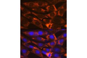 Immunofluorescence analysis of NIH-3T3 cells using G3BP11 Rabbit mAb (ABIN1683144, ABIN7101598, ABIN7101599 and ABIN7101600) at dilution of 1:100 (40x lens). (G3BP1 antibody)