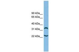 Image no. 1 for anti-Chromosome 6 Open Reading Frame 134 (C6orf134) (N-Term) antibody (ABIN6744726)
