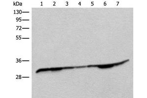 Western blot analysis of Rat heart tissue Mouse heart tissue Rat brain tissue Mouse brain tissue HEPG2 cell Jurkat and Lovo cell lysates using RSU1 Polyclonal Antibody at dilution of 1:400 (RSU1 antibody)