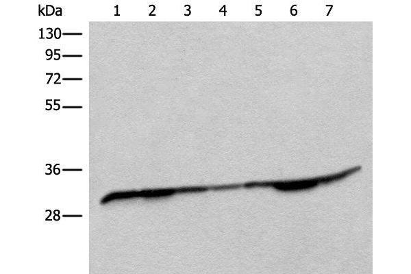 RSU1 antibody