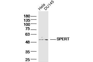 Lane 1: HeLa, Lane 2: DU145 cell lysates probed with SPERT Polyclonal Antibody  at 1:300 overnight at 4°C followed by a conjugated secondary antibody for 60 minutes at 37°C. (SPERT antibody  (AA 1-100))