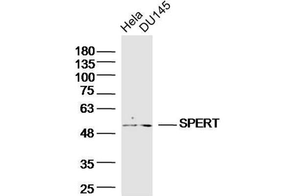 SPERT anticorps  (AA 1-100)