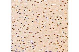 Immunohistochemistry (Paraffin-embedded Sections) (IHC (p)) image for anti-DMRT-Like Family A2 (DMRTA2) antibody (ABIN7073753)