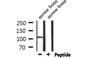 Western blot analysis of extracts from mouse brain, using CACNA2D4 Antibody.