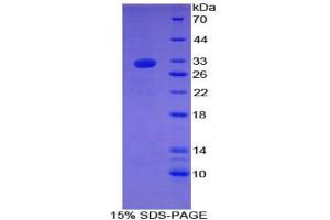 SDS-PAGE analysis of Rat Laminin gamma 1 Protein. (Laminin gamma 1 Protein)