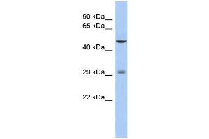 WB Suggested Anti-LBX1 Antibody Titration: 0. (Lbx1 antibody  (Middle Region))