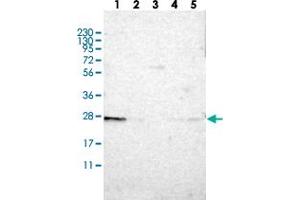 Western blot analysis of Lane 1: RT-4, Lane 2: U-251 MG, Lane 3: Human Plasma, Lane 4: Liver, Lane 5: Tonsil with TMED9 polyclonal antibody . (TMED9 antibody)