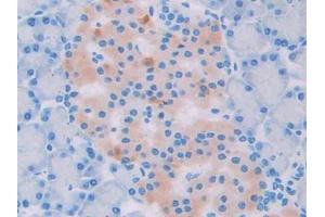 IHC-P analysis of Rat Pancreas Tissue, with DAB staining. (UCP2 antibody  (AA 99-216))