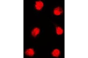 Immunofluorescent analysis of APTX staining in K562 cells. (Aprataxin antibody)