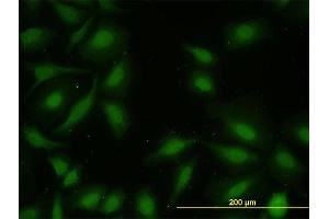 Immunofluorescence of monoclonal antibody to MAPKAPK2 on HeLa cell. (MAPKAP Kinase 2 antibody  (AA 302-400))