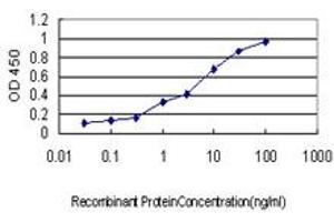 Detection limit for recombinant GST tagged FBXL18 is approximately 0.