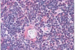 Human Thymus (formalin-fixed, paraffin-embedded) stained with CDC25B antibody ABIN214736 at 5 ug/ml followed by biotinylated goat anti-rabbit IgG secondary antibody ABIN481713, alkaline phosphatase-streptavidin and chromogen. (CDC25B antibody  (AA 56-105))