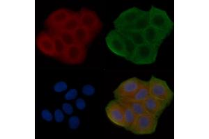 ABIN6258835 and ABIN6275157 staining Hela cells(30 min of UV treatment) by IF/ICC.