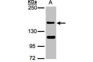 WB Image Sample(30 ug whole cell lysate) A:Raji , 5% SDS PAGE antibody diluted at 1:1000 (WHSC1 antibody  (N-Term))