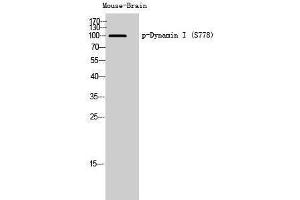 Western Blotting (WB) image for anti-Dynamin 1 (DNM1) (pSer778) antibody (ABIN3182341) (Dynamin 1 antibody  (pSer778))