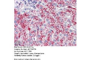 Immunohistochemistry with Human Liver cell lysate tissue at an antibody concentration of 5. (SP4 antibody  (Middle Region))