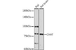 Western Blotting (WB) image for anti-Choline O-Acetyltransferase (CHAT) (AA 331-630) antibody (ABIN3016135)