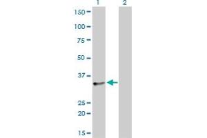 Western Blot analysis of SFRS10 expression in transfected 293T cell line by SFRS10 monoclonal antibody (M01), clone 7A1. (TRA2B antibody  (AA 120-199))