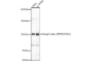 Western Blotting (WB) image for anti-Integrin beta 3 (ITGB3) (AA 609-788) antibody (ABIN6142583)