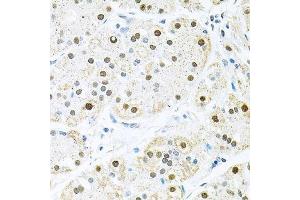 Immunohistochemistry of paraffin-embedded human stomach using BCCIP antibody. (BCCIP antibody  (AA 1-314))