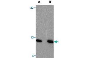 Western blot analysis of PSENEN in A-20 cell lysate with PSENEN polyclonal antibody  at (A) 0.