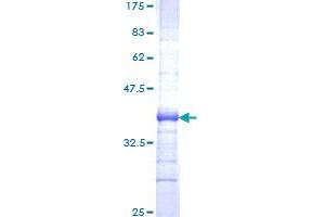 SCUBE3 Protein (AA 401-499) (GST tag)