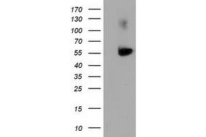 Image no. 1 for anti-Sequestosome 1 (SQSTM1) antibody (ABIN1499989) (SQSTM1 antibody)