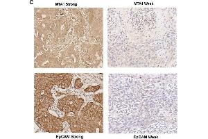 Immunohistochemistry (IHC) image for anti-Epithelial Cell Adhesion Molecule (EPCAM) (AA 40-260) antibody (ABIN3021638)