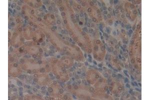 Detection of MMP3 in Rat Kidney Tissue using Monoclonal Antibody to Matrix Metalloproteinase 3 (MMP3) (MMP3 antibody  (AA 278-450))