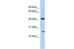WB Suggested Anti-KCNMB4 Antibody Titration:  0. (KCNMB4 antibody  (Middle Region))