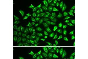 Immunofluorescence analysis of U2OS cells using MMRN1 Polyclonal Antibody (Multimerin 1 antibody)