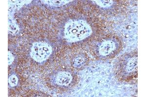 Immunohistochemistry (IHC) image for anti-beta-2-Microglobulin (B2M) antibody (ABIN6940415)