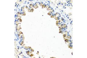 Immunohistochemistry of paraffin-embedded mouse lung using GNRH2 antibody. (GnRH2 antibody)