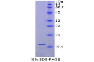 SDS-PAGE (SDS) image for Selenoprotein X, 1 (SEPX1) (AA 1-116) protein (His tag) (ABIN1878043)