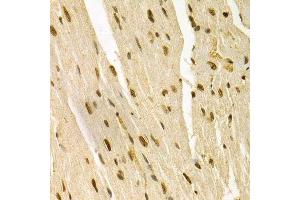 Immunohistochemistry (Paraffin-embedded Sections) (IHC (p)) image for anti-Mitogen-Activated Protein Kinase 3 (MAPK3) (AA 1-100) antibody (ABIN3020725)