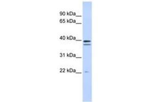 Image no. 1 for anti-Rab Geranylgeranyltransferase, beta Subunit (RABGGTB) (C-Term) antibody (ABIN6741035) (RABGGTB antibody  (C-Term))