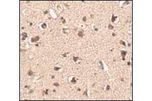 Immunohistochemistry of Slitrk6 in human brain tissue with this product at 2. (SLITRK6 antibody  (Center))