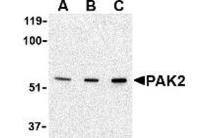 Western Blotting (WB) image for anti-P21-Activated Kinase 2 (PAK2) (N-Term) antibody (ABIN1031502) (PAK2 antibody  (N-Term))