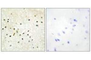 Immunohistochemistry analysis of paraffin-embedded human brain tissue using TF2H1 antibody. (GTF2H1 antibody  (N-Term))