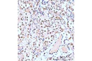 IHC analysis of Nesprin3/SYNE3 using anti-Nesprin3/SYNE3 antibody (ABIN7601328). (Nesprin3 antibody  (AA 322-495))