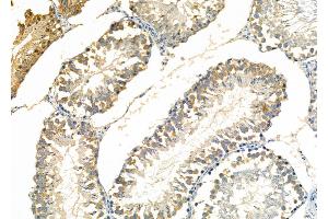 ABIN6261307 and ABIN6277247 at 1/100 staining Rat testis tissue by IHC-P.